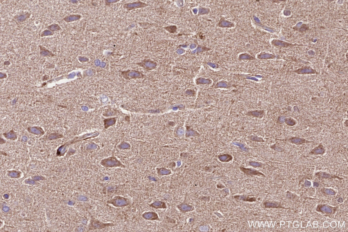 Immunohistochemistry (IHC) staining of rat brain tissue using NDUFA8 Polyclonal antibody (15064-1-AP)