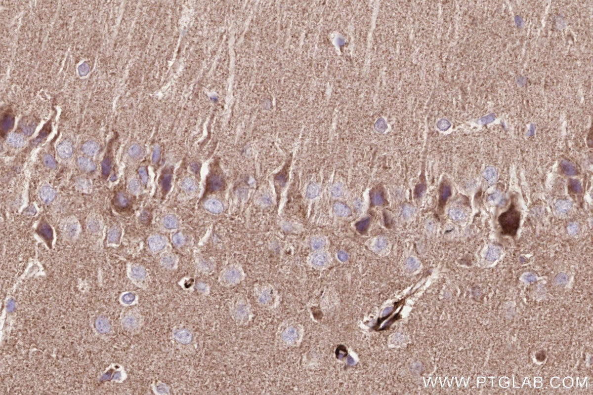 Immunohistochemistry (IHC) staining of rat brain tissue using NDUFA8 Polyclonal antibody (15064-1-AP)