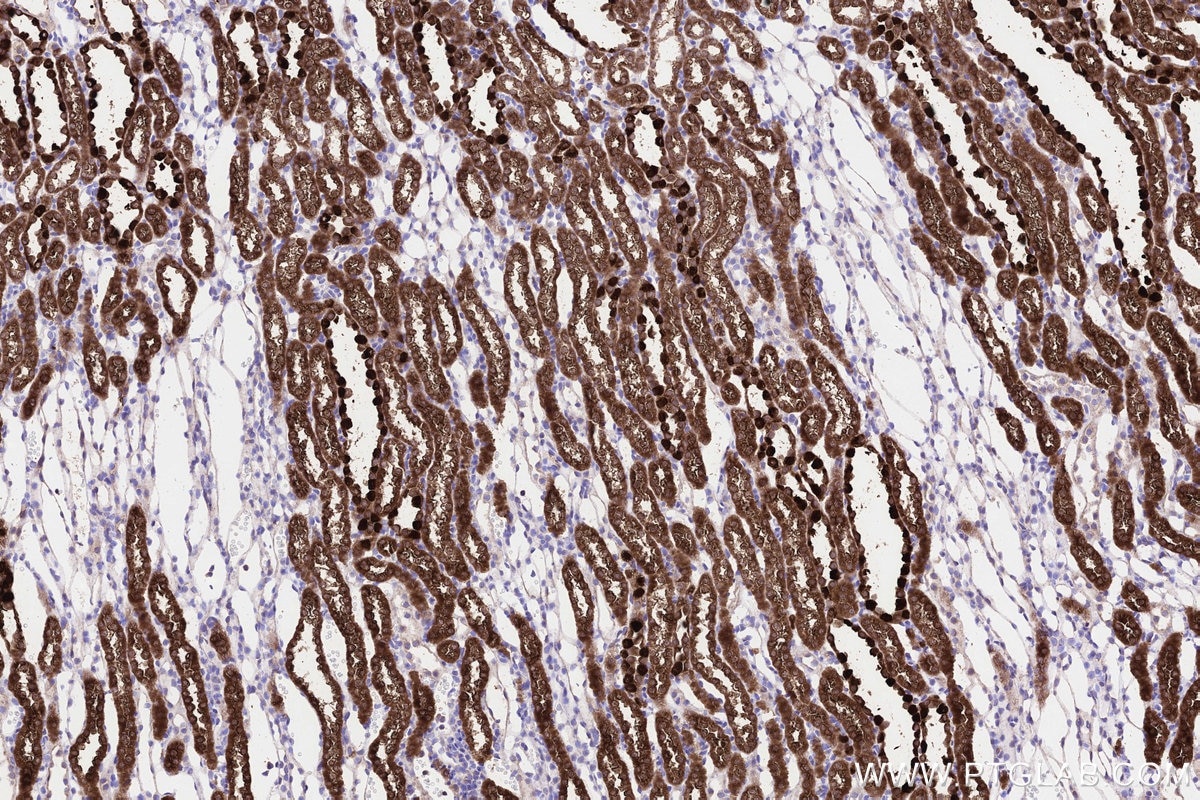 Immunohistochemistry (IHC) staining of rat kidney tissue using NDUFA8 Polyclonal antibody (15064-1-AP)