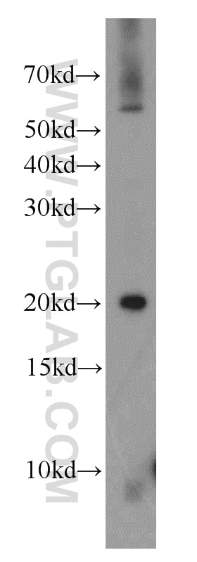 Western Blot (WB) analysis of human heart tissue using NDUFA8 Polyclonal antibody (15064-1-AP)