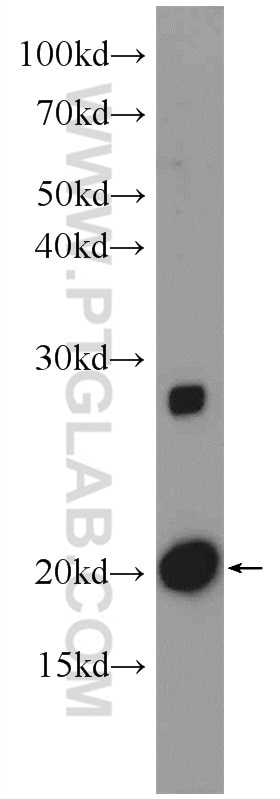 Western Blot (WB) analysis of mouse heart tissue using NDUFA8 Polyclonal antibody (15064-1-AP)