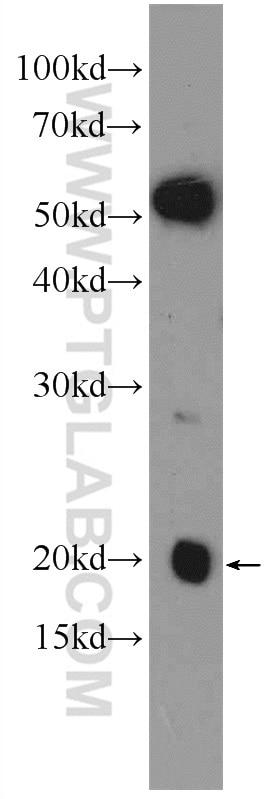 Western Blot (WB) analysis of mouse liver tissue using NDUFA8 Polyclonal antibody (15064-1-AP)