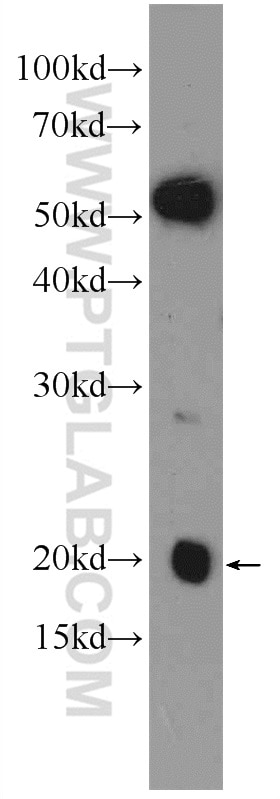 WB analysis of mouse liver using 15064-1-AP