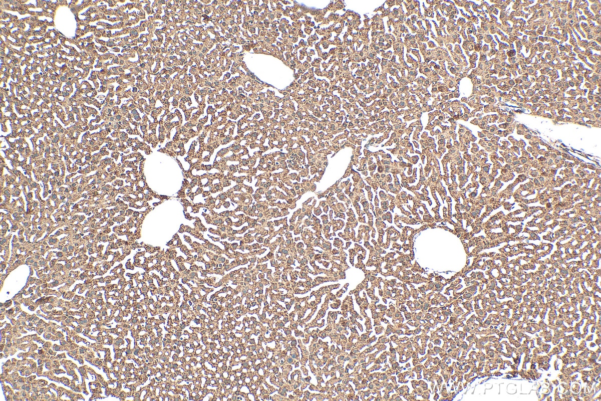 Immunohistochemistry (IHC) staining of mouse liver tissue using NDUFA9 Polyclonal antibody (20312-1-AP)