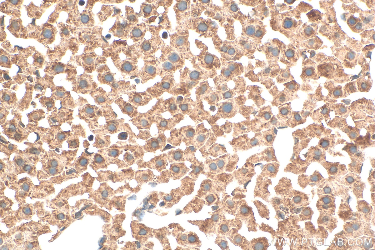 Immunohistochemistry (IHC) staining of mouse liver tissue using NDUFA9 Polyclonal antibody (20312-1-AP)