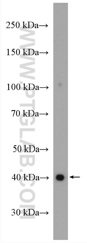 Western Blot (WB) analysis of mouse skeletal muscle tissue using NDUFA9 Polyclonal antibody (20312-1-AP)