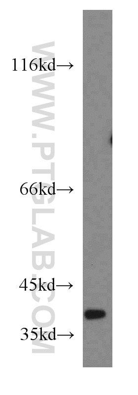 Western Blot (WB) analysis of human skeletal muscle tissue using NDUFA9 Polyclonal antibody (20312-1-AP)