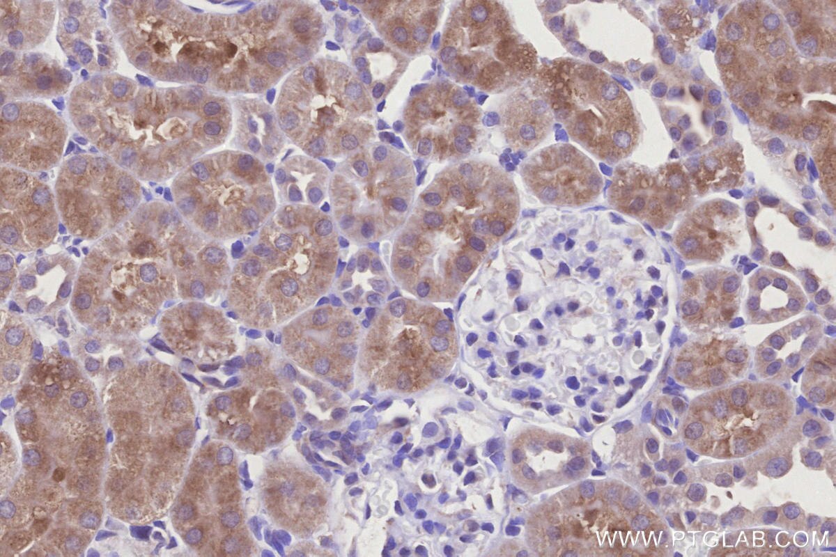 Immunohistochemical analysis of paraffin-embedded rat kidney tissue slide using 29621-1-AP (NDUFA9 antibody) at dilution of 1:500 (under 40x lens). Heat mediated antigen retrieval with Tris-EDTA buffer (pH 9.0). Immunohistochemistry (IHC) staining of rat kidney tissue using NDUFA9 Polyclonal antibody (29621-1-AP)