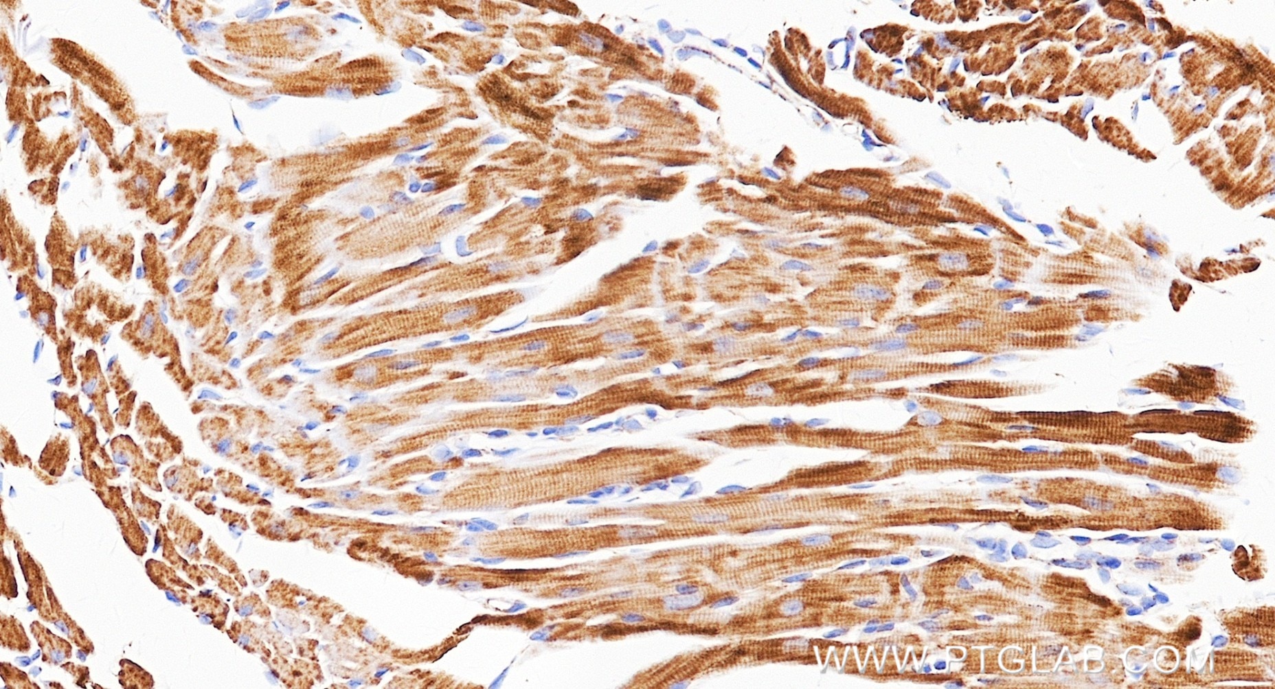 IHC staining of mouse heart using 87143-2-RR Immunohistochemistry (IHC) staining of mouse heart tissue using NDUFA9 Recombinant monoclonal antibody (87143-2-RR)