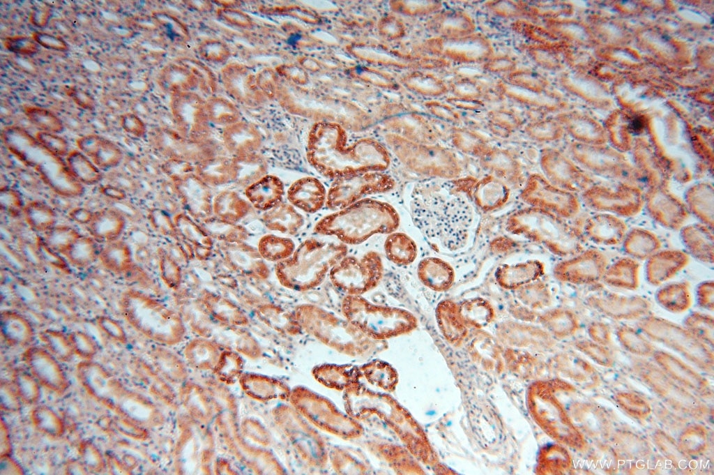 Immunohistochemistry (IHC) staining of human kidney tissue using NDUFAF1 Polyclonal antibody (15181-1-AP)