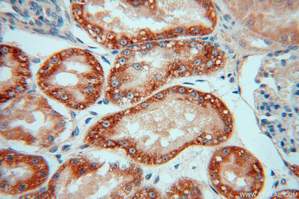 Immunohistochemistry (IHC) staining of human kidney tissue using NDUFAF1 Polyclonal antibody (15181-1-AP)