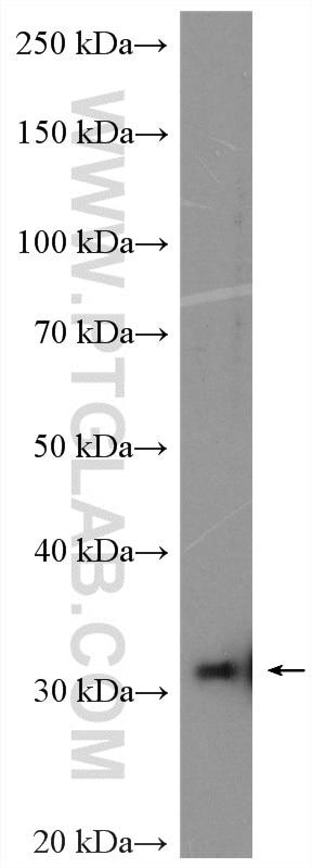 Western Blot (WB) analysis of Jurkat cells using NDUFAF1 Polyclonal antibody (15181-1-AP)