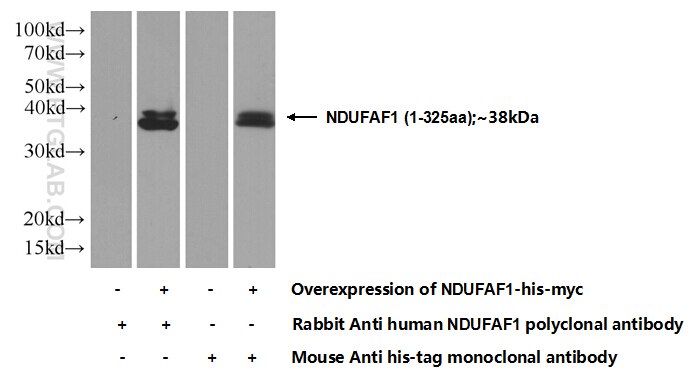 Western Blot (WB) analysis of Transfected HEK-293 cells using NDUFAF1 Polyclonal antibody (15181-1-AP)