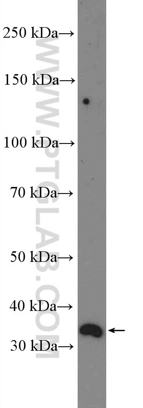 Western Blot (WB) analysis of HeLa cells using NDUFAF1 Polyclonal antibody (15181-1-AP)