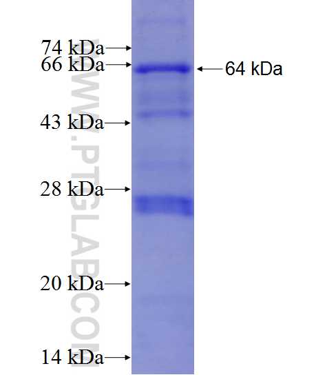 NDUFAF1 fusion protein Ag7162 SDS-PAGE