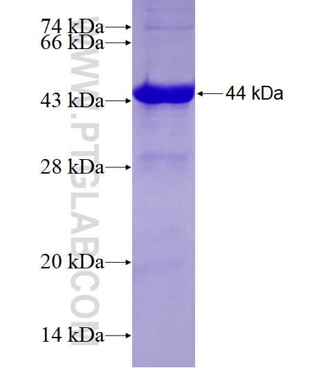 NDUFAF1 fusion protein Ag7224 SDS-PAGE