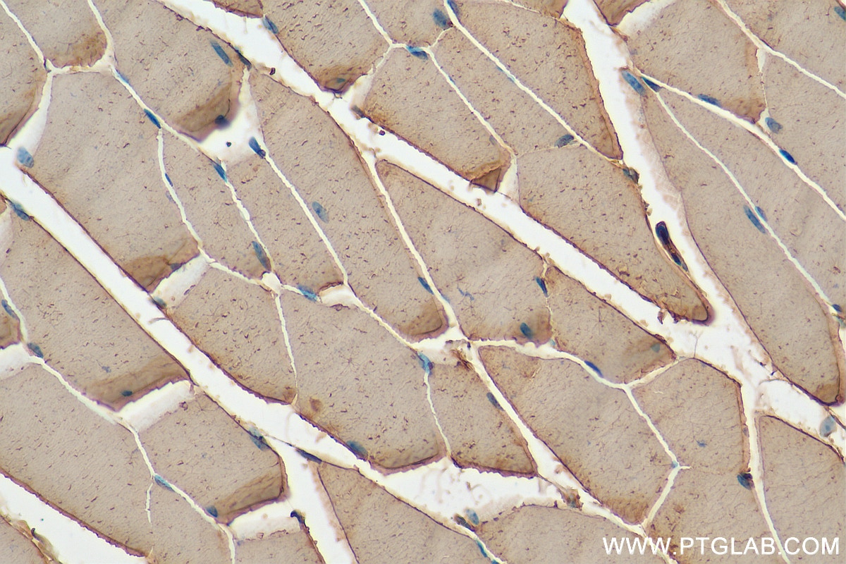 Immunohistochemistry (IHC) staining of mouse skeletal muscle tissue using NDUFAF2 Polyclonal antibody (13891-1-AP)