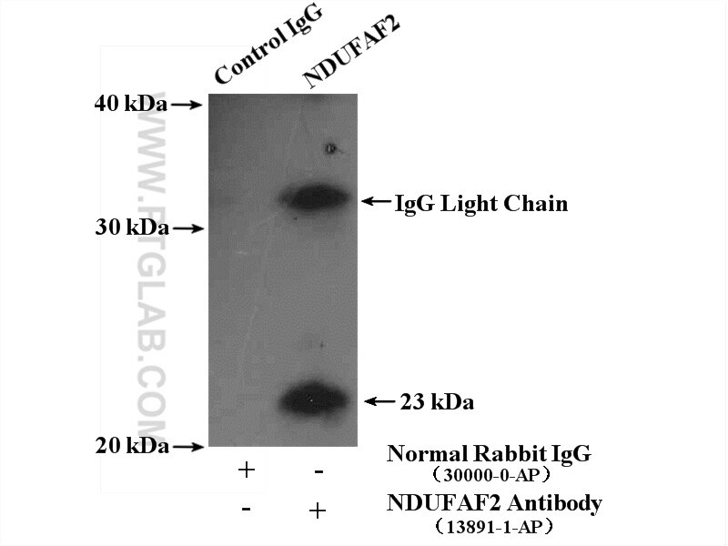 Immunoprecipitation (IP) experiment of SH-SY5Y cells using NDUFAF2 Polyclonal antibody (13891-1-AP)
