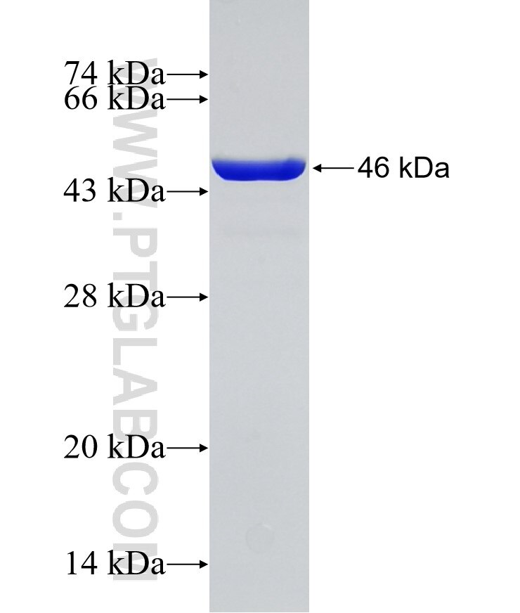 NDUFAF2 fusion protein Ag4853 SDS-PAGE