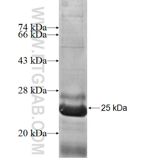 NDUFAF2 fusion protein Ag5304 SDS-PAGE