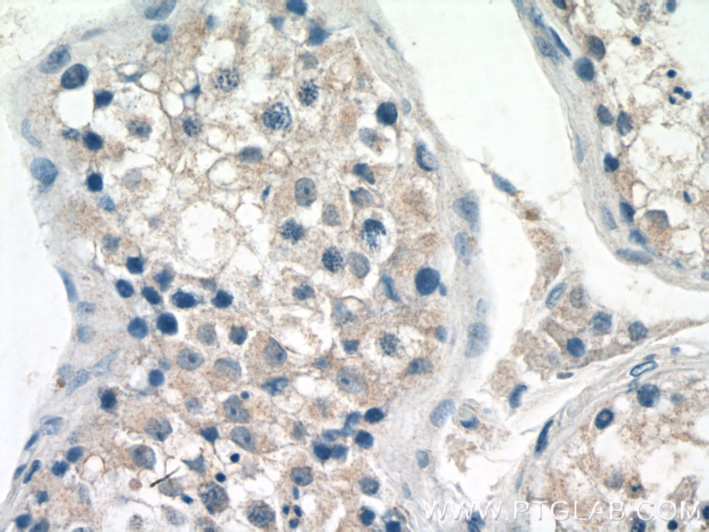 Immunohistochemistry (IHC) staining of human testis tissue using NDUFAF4 Polyclonal antibody (26003-1-AP)