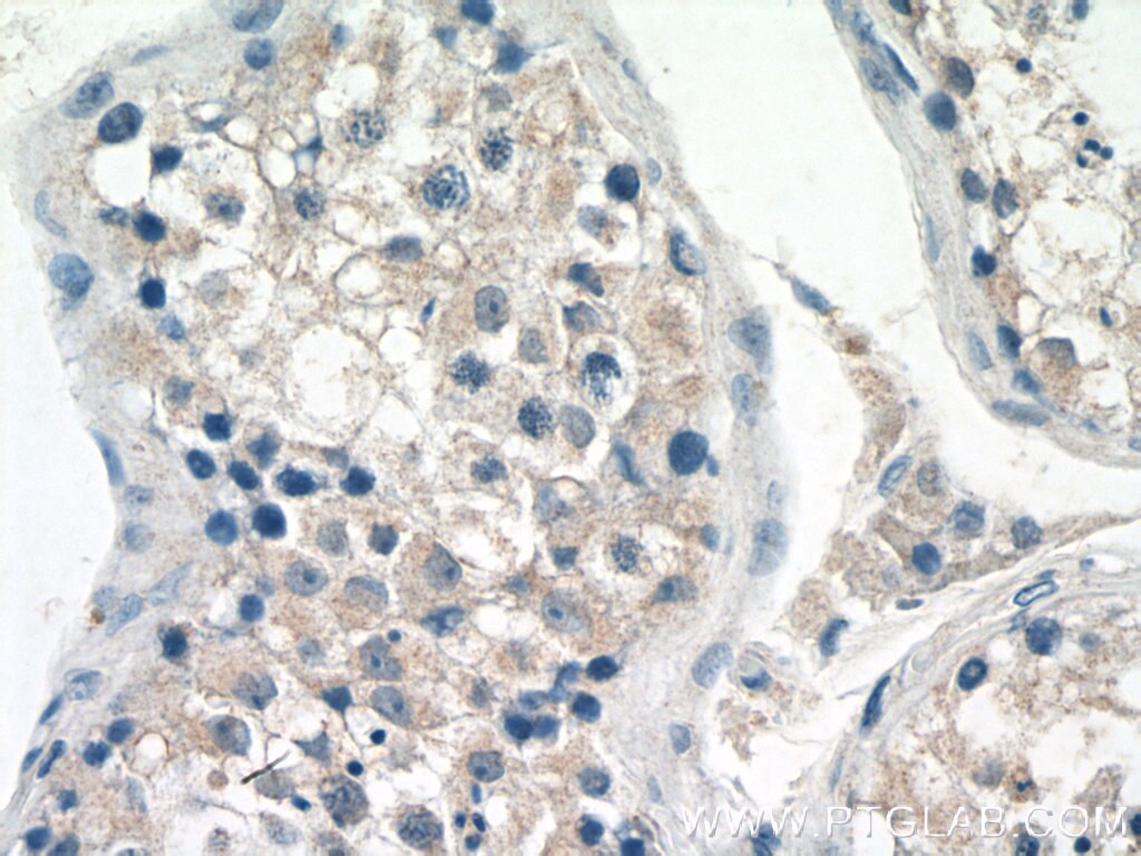 IHC staining of human testis using 26003-1-AP