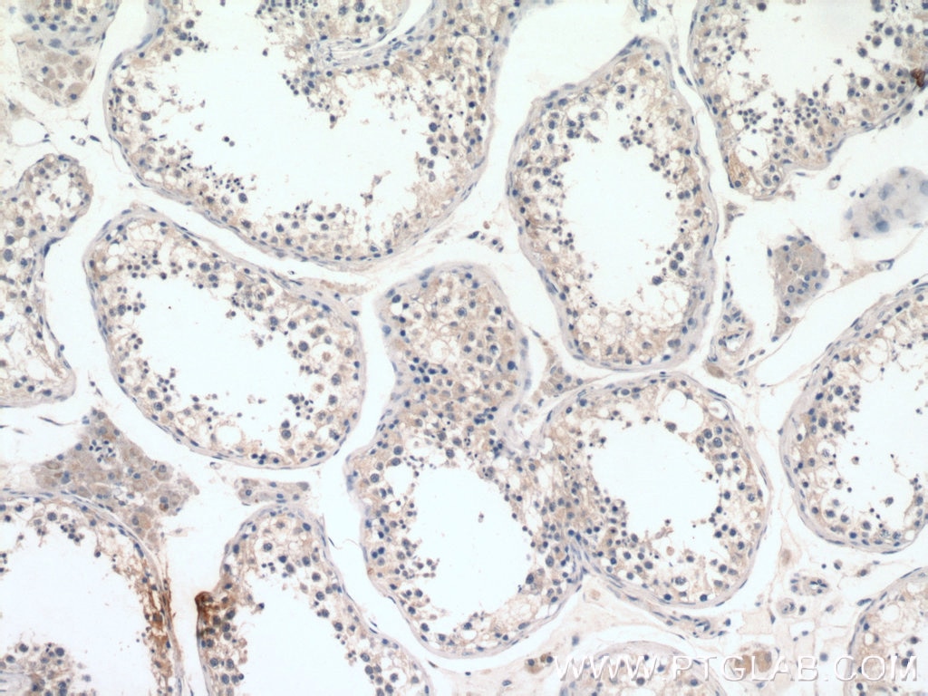 IHC staining of human testis using 26003-1-AP