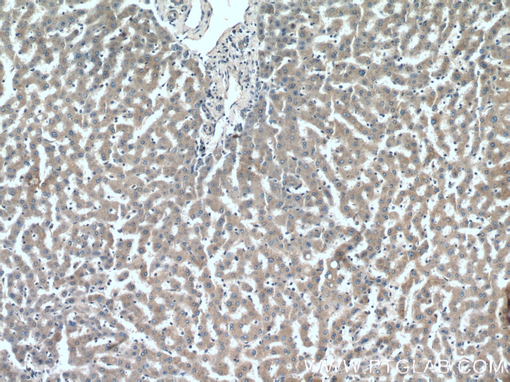 Immunohistochemistry (IHC) staining of human liver tissue using NDUFAF4 Polyclonal antibody (26003-1-AP)