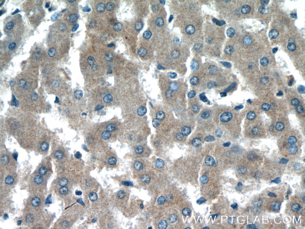 Immunohistochemistry (IHC) staining of human liver tissue using NDUFAF4 Polyclonal antibody (26003-1-AP)