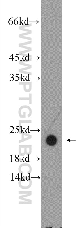 Western Blot (WB) analysis of MDA-MB-453s cells using NDUFAF4 Polyclonal antibody (26003-1-AP)