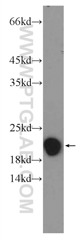 Western Blot (WB) analysis of K-562 cells using NDUFAF4 Polyclonal antibody (26003-1-AP)