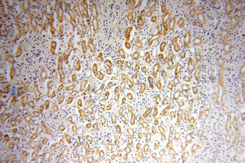 Immunohistochemistry (IHC) staining of human kidney tissue using NDUFB1 Polyclonal antibody (16902-1-AP)