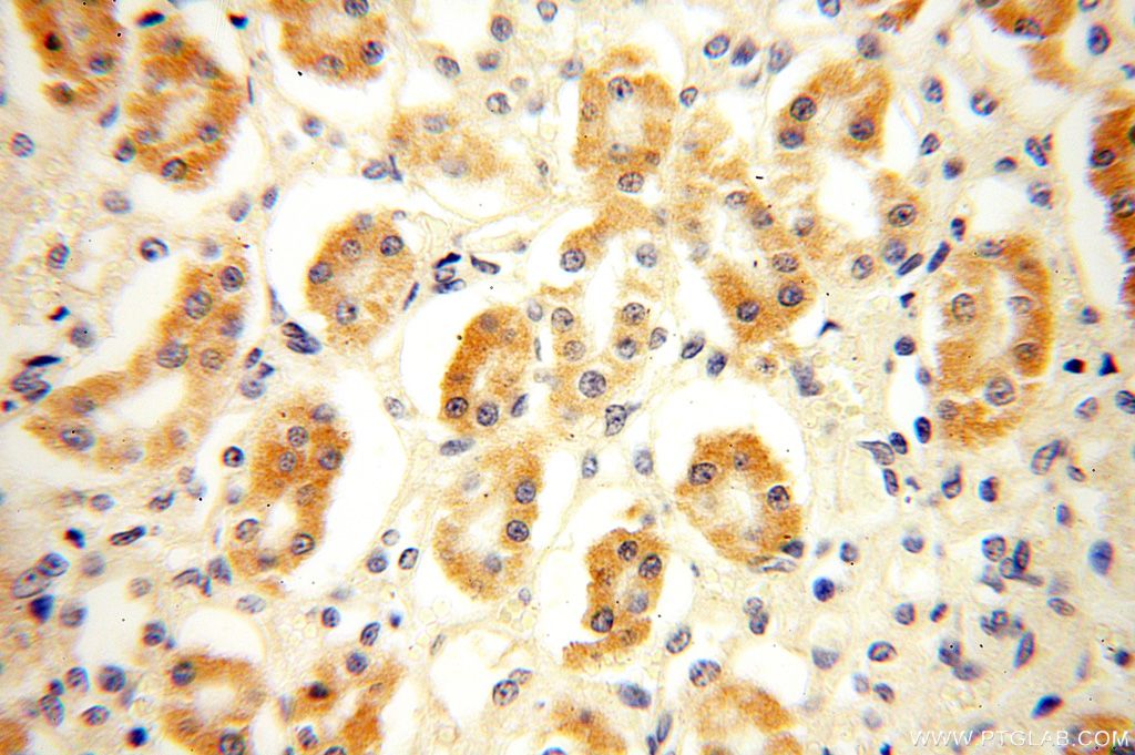 Immunohistochemistry (IHC) staining of human kidney tissue using NDUFB1 Polyclonal antibody (16902-1-AP)