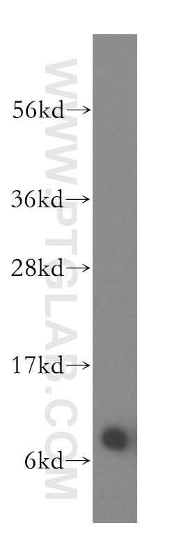 Western Blot (WB) analysis of human colon tissue using NDUFB1 Polyclonal antibody (16902-1-AP)