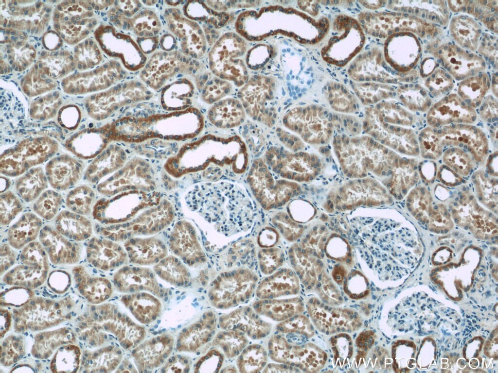 Immunohistochemistry (IHC) staining of human kidney tissue using NDUFB10 Polyclonal antibody (15589-1-AP)