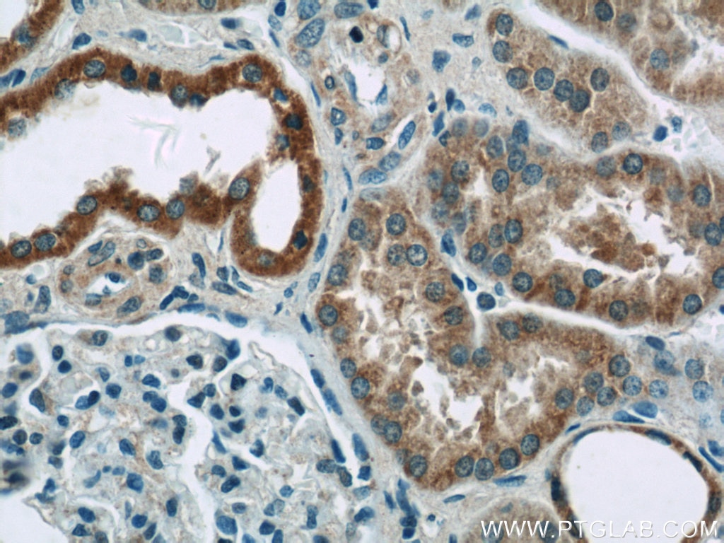 Immunohistochemistry (IHC) staining of human kidney tissue using NDUFB10 Polyclonal antibody (15589-1-AP)