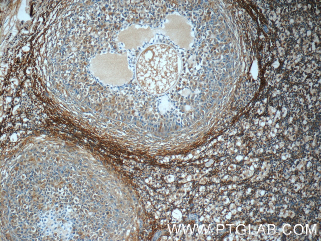 Immunohistochemistry (IHC) staining of human ovary tissue using NDUFB10 Polyclonal antibody (15589-1-AP)