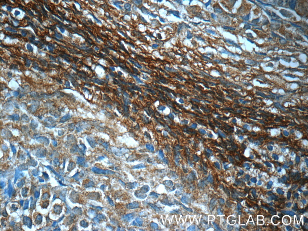 Immunohistochemistry (IHC) staining of human ovary tissue using NDUFB10 Polyclonal antibody (15589-1-AP)