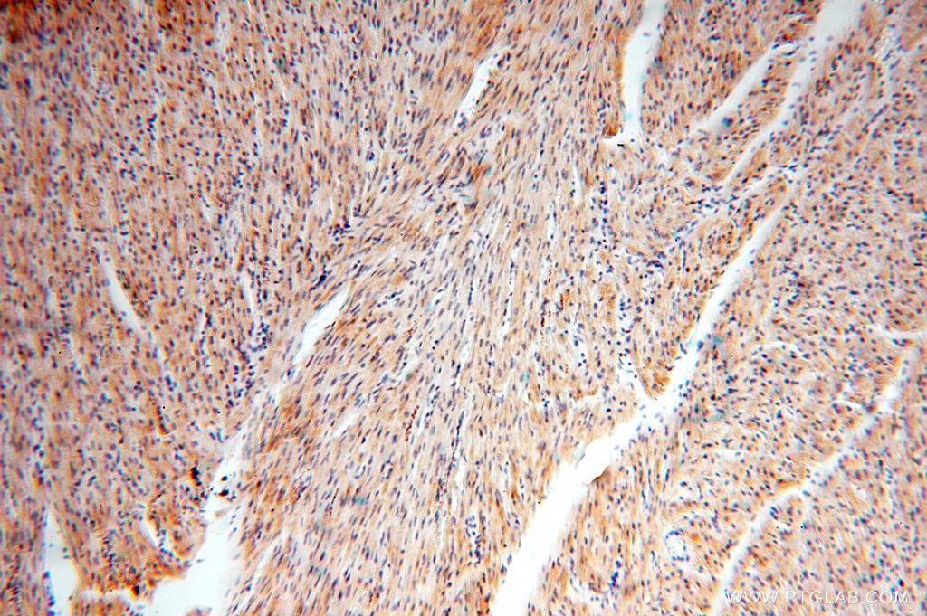 Immunohistochemistry (IHC) staining of human heart tissue using NDUFB10 Polyclonal antibody (15589-1-AP)