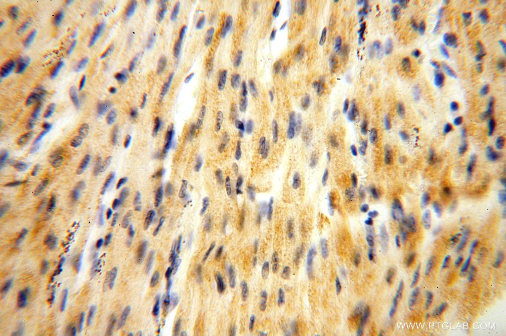 IHC staining of human heart using 15589-1-AP