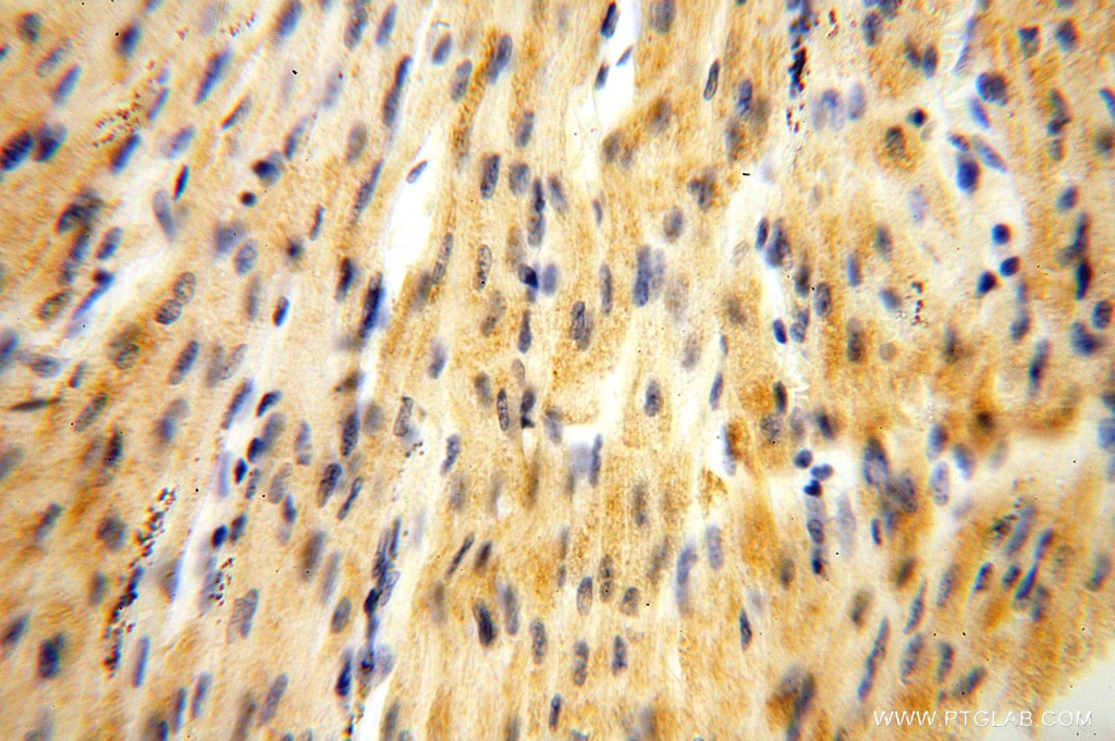 Immunohistochemistry (IHC) staining of human heart tissue using NDUFB10 Polyclonal antibody (15589-1-AP)