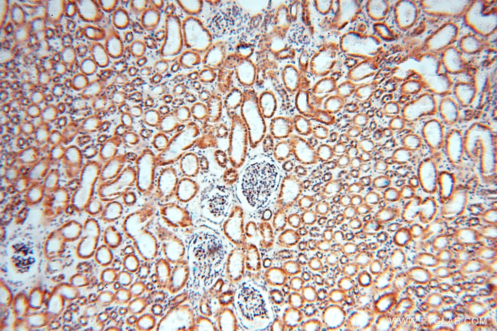 Immunohistochemistry (IHC) staining of human kidney tissue using NDUFB10 Polyclonal antibody (15589-1-AP)