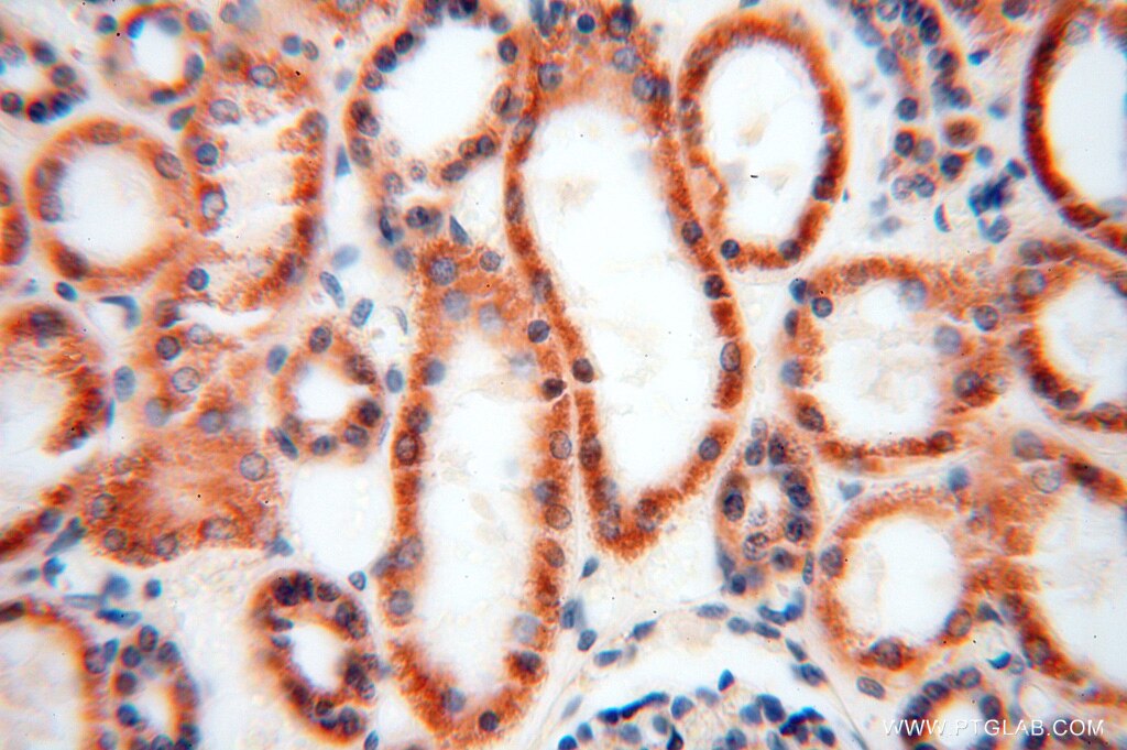 Immunohistochemistry (IHC) staining of human kidney tissue using NDUFB10 Polyclonal antibody (15589-1-AP)