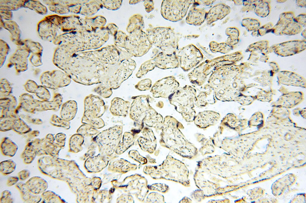 IHC staining of human placenta using 15589-1-AP