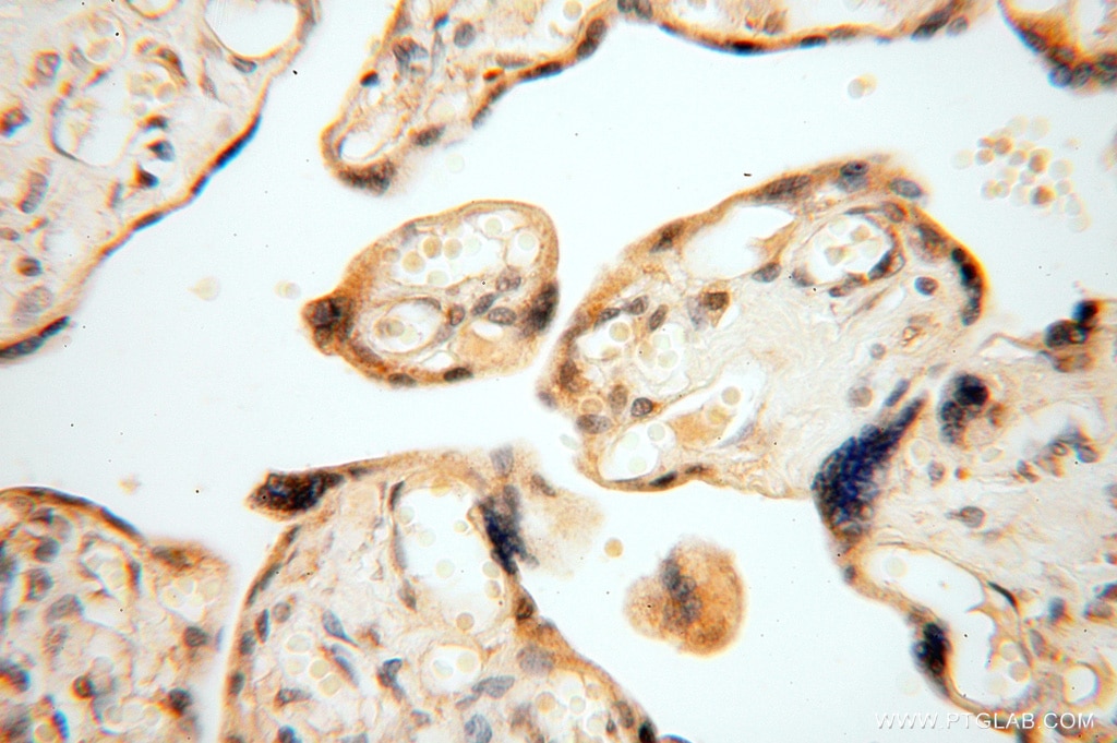 Immunohistochemistry (IHC) staining of human placenta tissue using NDUFB10 Polyclonal antibody (15589-1-AP)