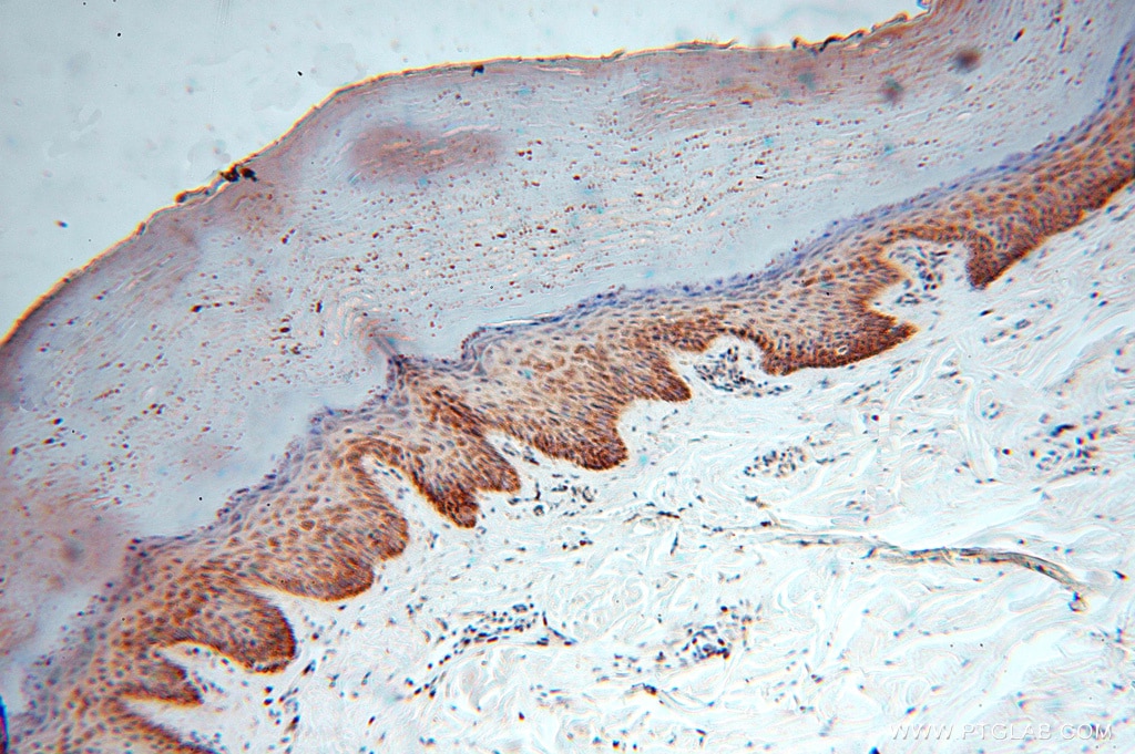 Immunohistochemistry (IHC) staining of human skin tissue using NDUFB10 Polyclonal antibody (15589-1-AP)