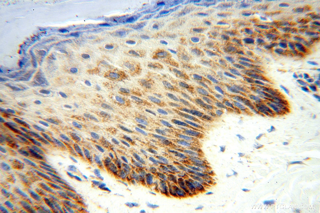 Immunohistochemistry (IHC) staining of human skin tissue using NDUFB10 Polyclonal antibody (15589-1-AP)