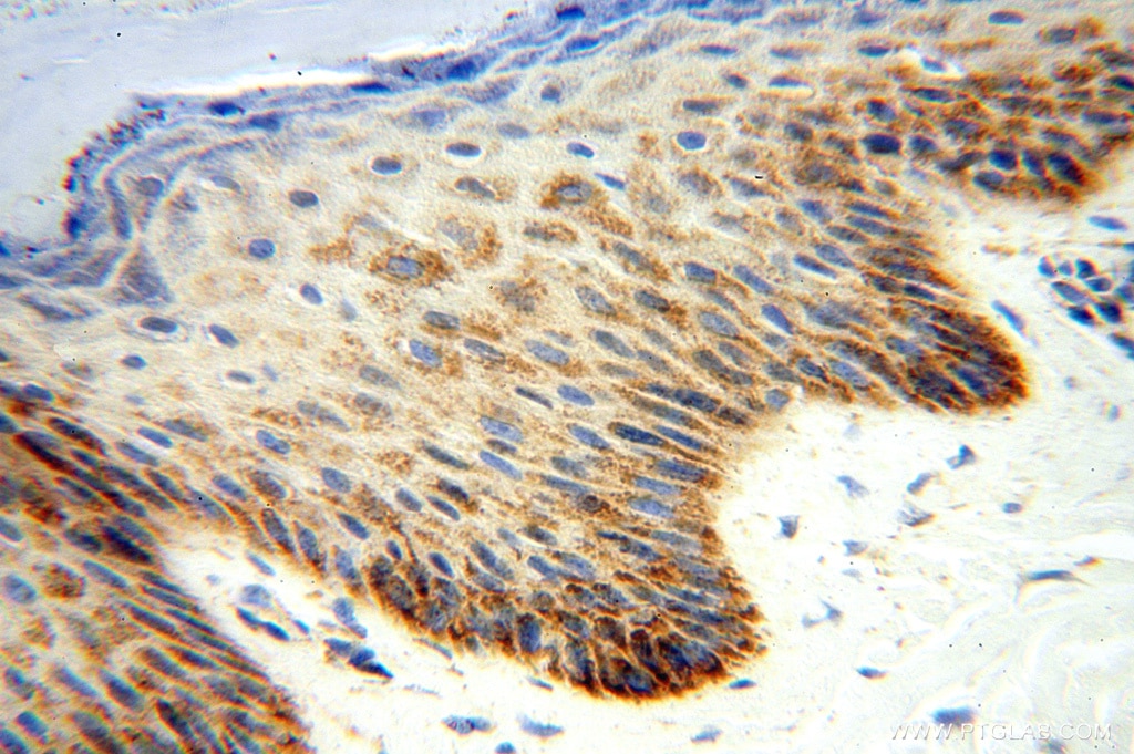 IHC staining of human skin using 15589-1-AP