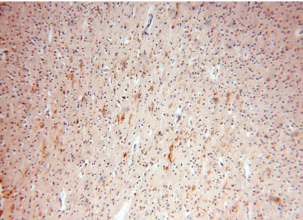 Immunohistochemistry (IHC) staining of human brain tissue using NDUFB10 Polyclonal antibody (15589-1-AP)