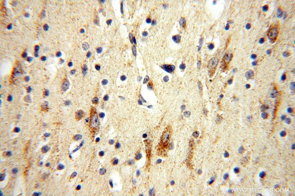 Immunohistochemistry (IHC) staining of human brain tissue using NDUFB10 Polyclonal antibody (15589-1-AP)